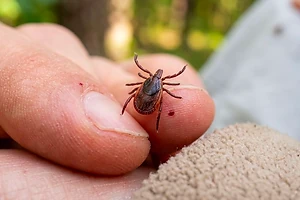 7 случаев клещевого энцефалита зарегистрировали в СКО: сезон активности клещей продолжается