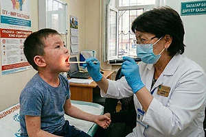 38 человек заболели корью с начала года в СКО